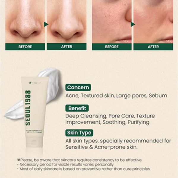 K-Secret Seoul 1988 Pine Cica 1% + Probiotics Cleansing Foam -150ml